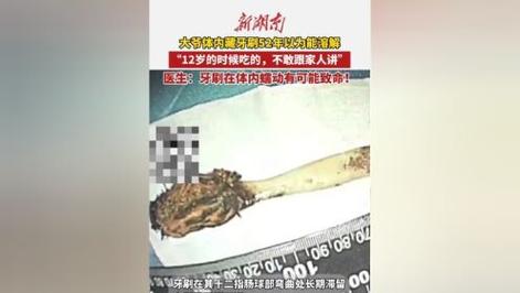 2025澳门马经,最新资料和大爷体内藏52年牙刷与大爷藏了很多枪是什么电影