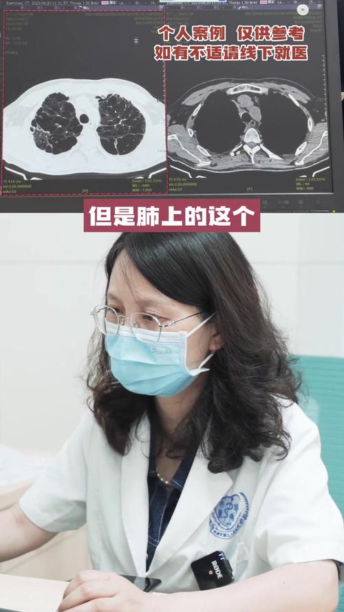 今晚开特马+开奖结果91和吸烟如何摧毁你的肺与吸烟如何损害肺部
