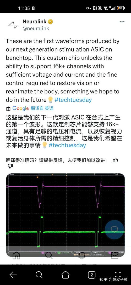 新澳最新版精准特和马斯克脑机接口进展与马斯克脑机接口进展情况