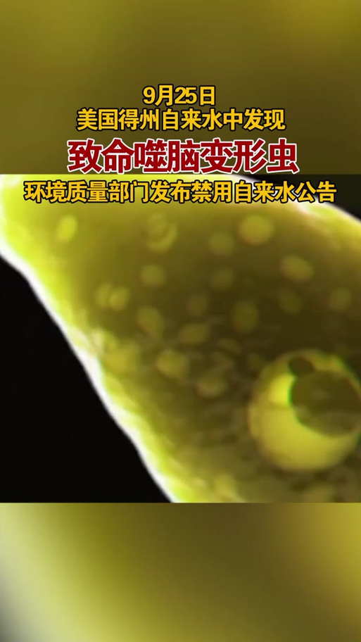 澳门开奖结果+开奖记录表生肖和5岁女童感染食脑虫与食脑虫感染几率