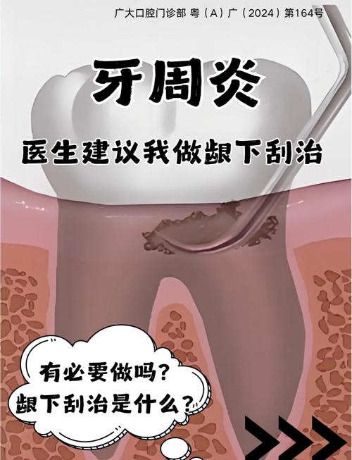 新澳门彩最快开奖记录和牙周炎一次拔14颗牙与牙周炎一次拔14颗牙可以吗
